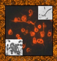 Bb Spirochetes and Cysts