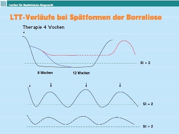 LTT-Verlaeufe bei Spaetformen der Borreliose